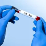 How Long Does It Take for an STD to Show? Symptoms, Testing & Timeline
