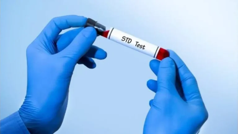 How Long Does It Take for an STD to Show? Symptoms, Testing & Timeline