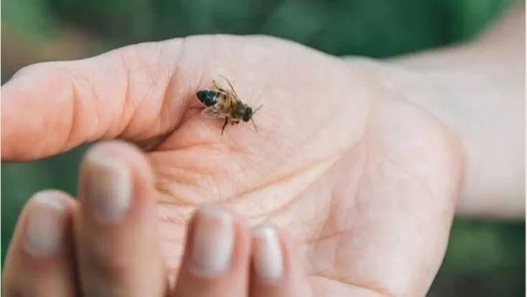 Home Remedies for Bee Stings