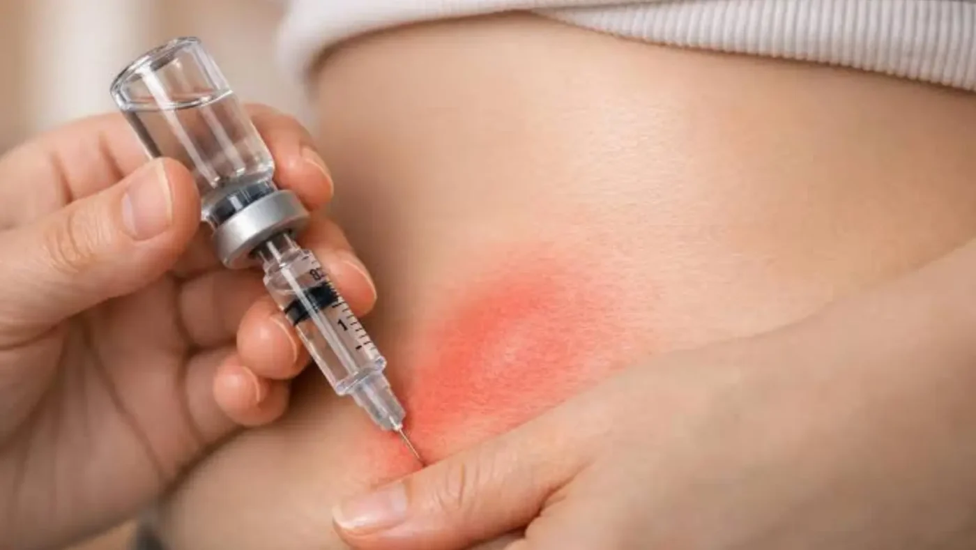 GLP-1 Injection Sites Guide: Stomach, Thigh or Upper Arm?