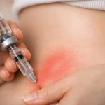 GLP-1 Injection Sites Guide: Stomach, Thigh or Upper Arm?