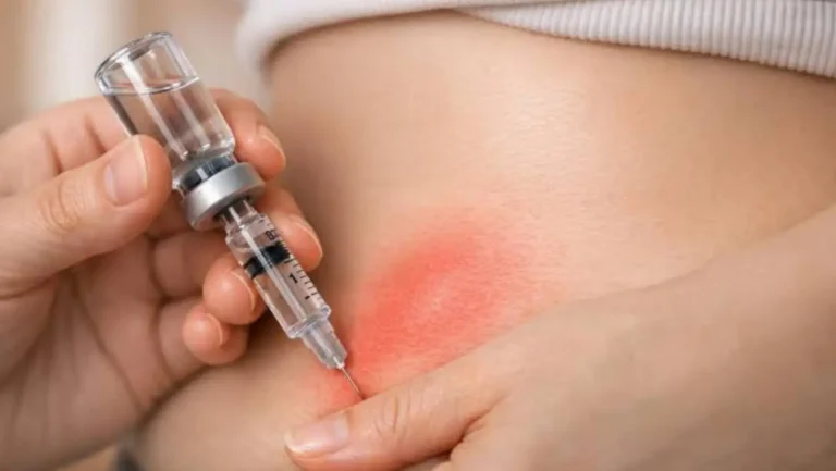 GLP-1 Injection Sites Guide: Stomach, Thigh or Upper Arm?