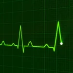 What Is Heart Rate Variability? Meaning, Benefits & Why It Matters