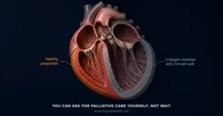 End Stage Heart Failure: Symptoms, Life Expectancy, and Comfort Care