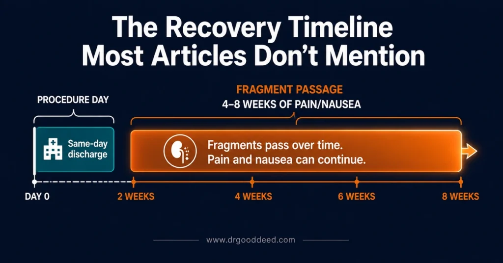 Kidney stone lithotripsy fragment recovery time