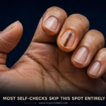 Signs of Skin Cancer: What to Look For