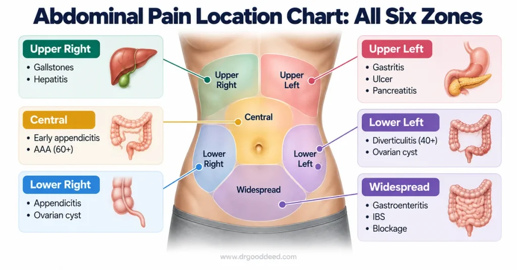 Abdominal pain six zone location chart complete