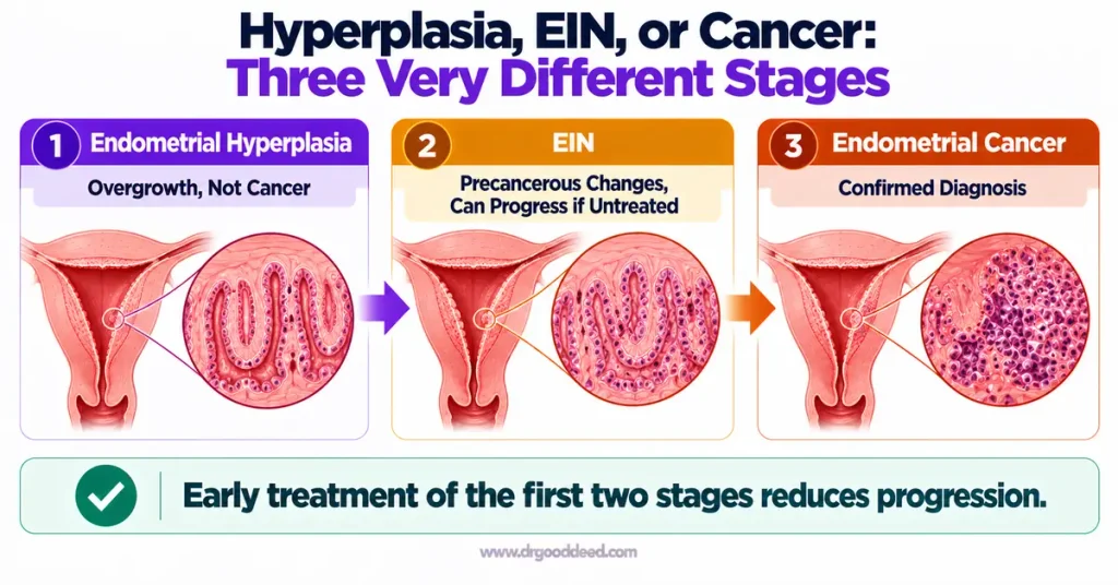 Endometrial hyperplasia EIN and cancer progression stages