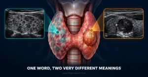 heterogeneous-thyroid-diffuse-vs-nodule-difference