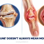 Osteoarthritis vs Rheumatoid Arthritis: What’s the Real Difference?