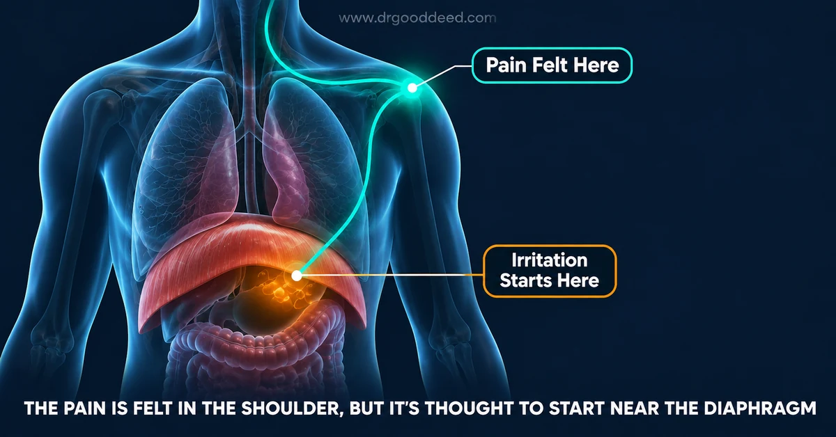 Why Does Gas Pain Go to My Shoulder?