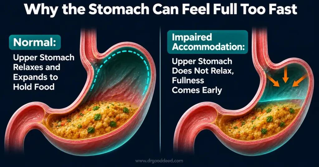 gastric-accommodation-early-satiety-stomach-cutaway-diagram