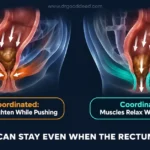 Feeling of Incomplete Bowel Movement: Causes and Relief